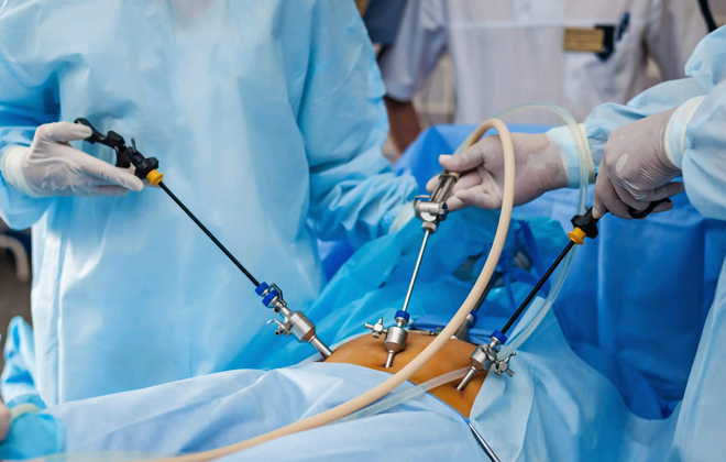 Laparoscopic surgery also known as minimally invasive surgery involves performing surgical procedures through small incisions in the abdomen.